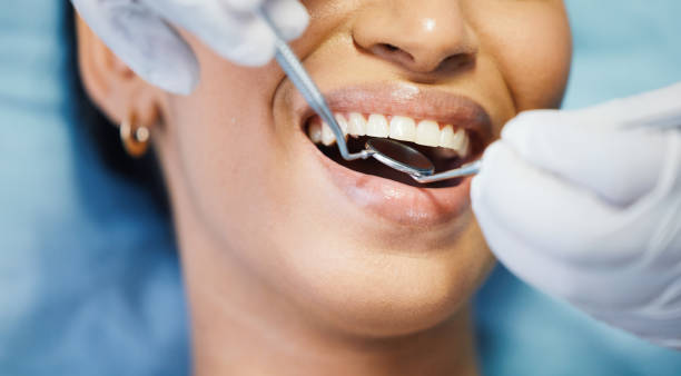 Best Emergency Wisdom Teeth Removal in Yorktown, IN