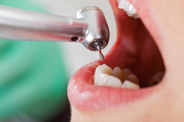 Best Emergency Broken Tooth Repair in Yorktown, IN